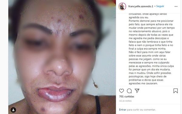 “Ele sempre pedia desculpas e falava que não lembrava”, conta mulher agredida a socos em Ilhéus; homem está foragido